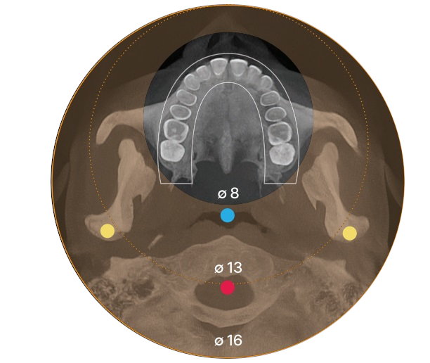 Diagnóstico digital con escáner dental 5D e inteligencia artificial
