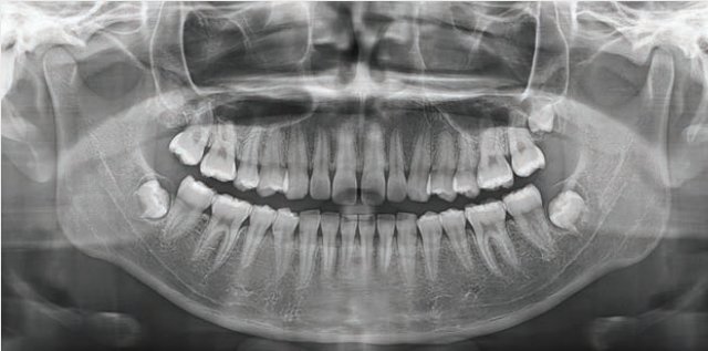 Escáner facial dental 5D para planificación personalizada