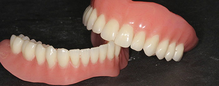 Prótesis removibles en Clinica dental Carvajal de Jaen