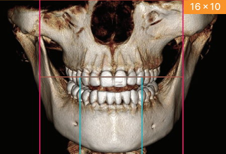 Radiografía 3D CBCT de alta resolución para diagnóstico dental en Jaén